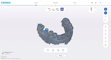 Rapid 3 Intraoral Scanner